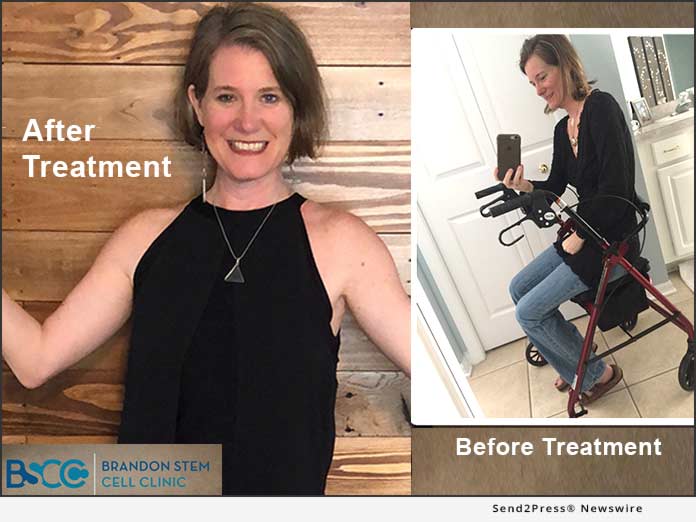 Brandon Stem Cell Clinic Offers Lifechanging Treatment Options